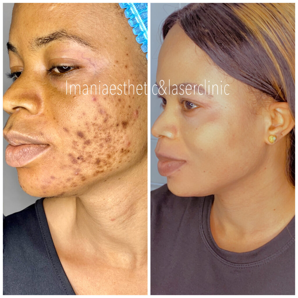 created by photogrid